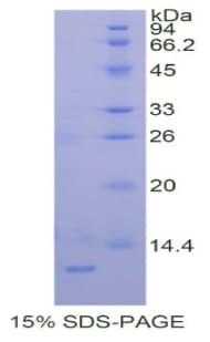 Human PRAME Protein (Recombinant His)