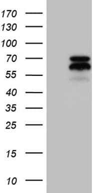 AIFM1 / AIF / PDCD8 Antibody (aa134-483, clone OTI4E6, Carrier-free)