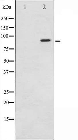 Polyclonal Rabbit anti-Human NBN / Nibrin Antibody (phospho-Ser343, IF, WB)