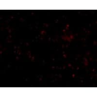 SCARB1 / SR-BI Antibody