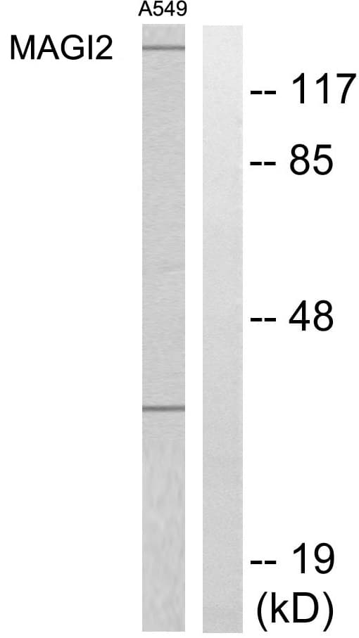 MAGI2 / AIP-1 Antibody (aa221-270)