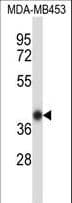 HOXC11 Antibody (aa1-30)