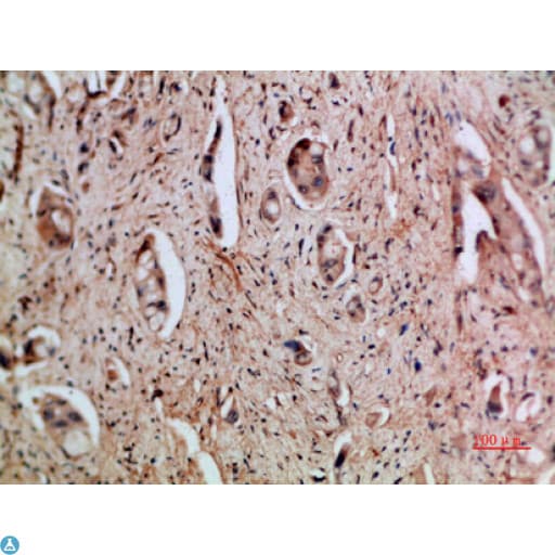 CXCL5 Antibody