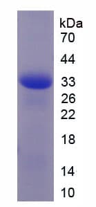 Mouse Basigin / Emmprin / CD147 Protein (Recombinant 6His, N-terminus)