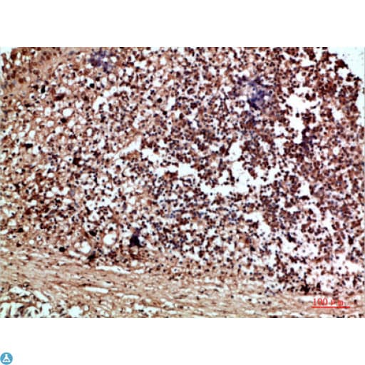 RCC1 Antibody