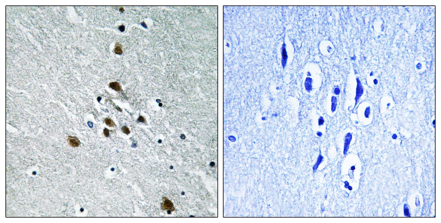 SF1 Antibody (phospho-Ser82)