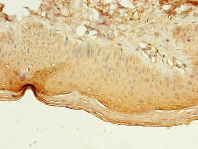 LILRA4 / ILT7 Antibody