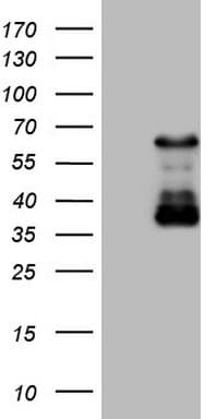 CAMK2B / CaMKII Beta Antibody (aa311-385, clone OTI10G2)