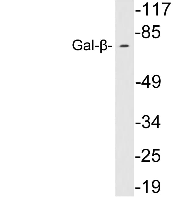 Polyclonal Rabbit anti-Human GLB1 / Beta-Galactosidase Antibody (aa490-539, WB)