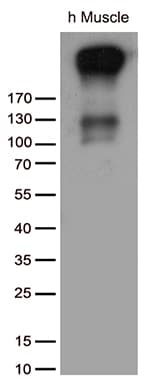 ATP2A2 / SERCA2 Antibody (aa314-756, clone OTI4B12)