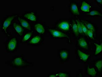 MAGI2 / AIP-1 Antibody