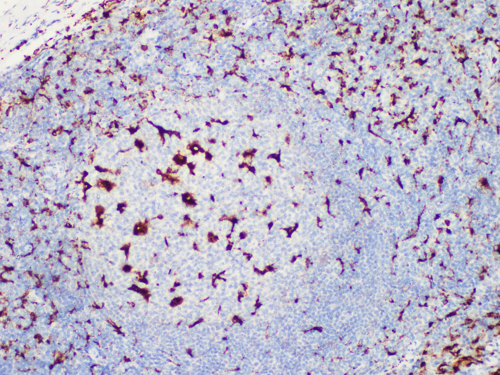 CD68 Antibody