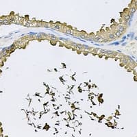 Polyclonal Rabbit anti-Human RNASE13 Antibody (IHC, IF, WB)