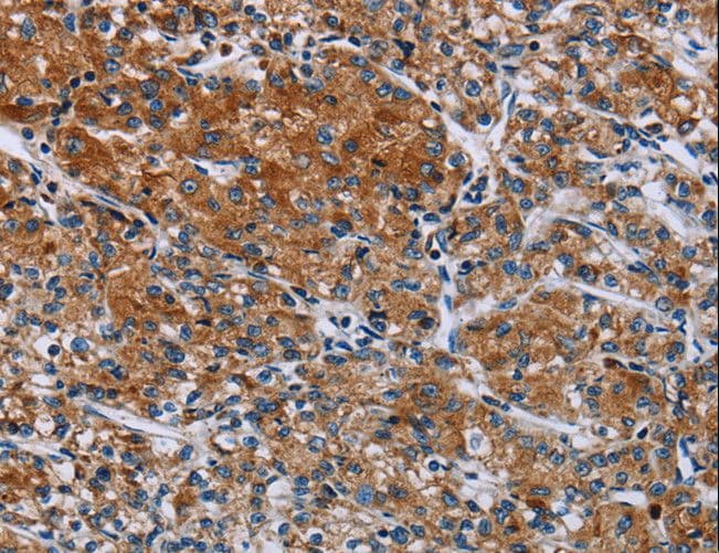 HYAL3 Antibody