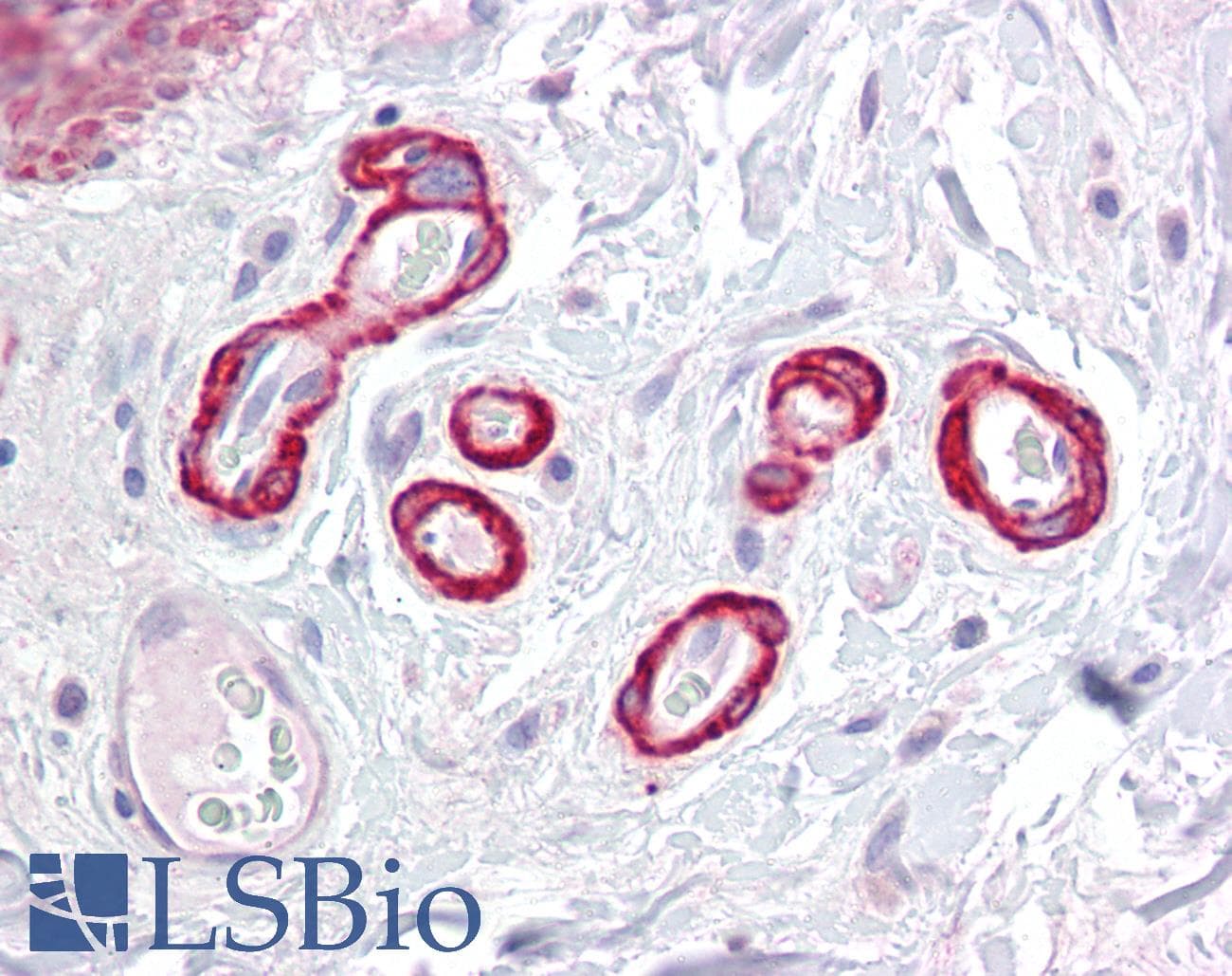 IHC-plus™ Polyclonal Rabbit anti-Human SLC39A14 / ZIP14 Antibody (IHC, IF, WB)