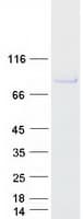 Human AOC2 / SSAO Protein (Recombinant Myc-DDK (Flag))