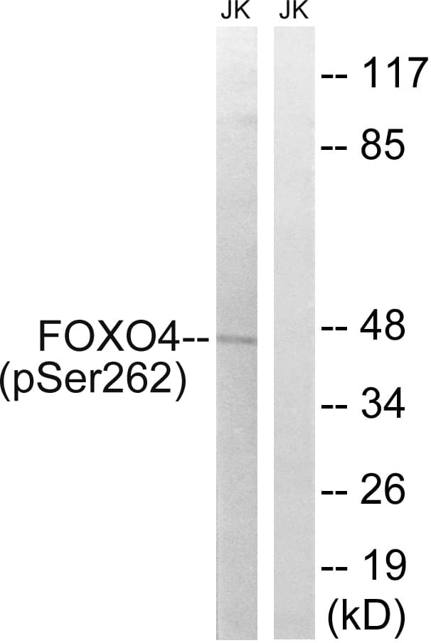 FOXO4 / AFX1 Antibody (phospho-Ser262)