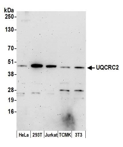 QCR2 / UQCRC2 Antibody (aa1-50)