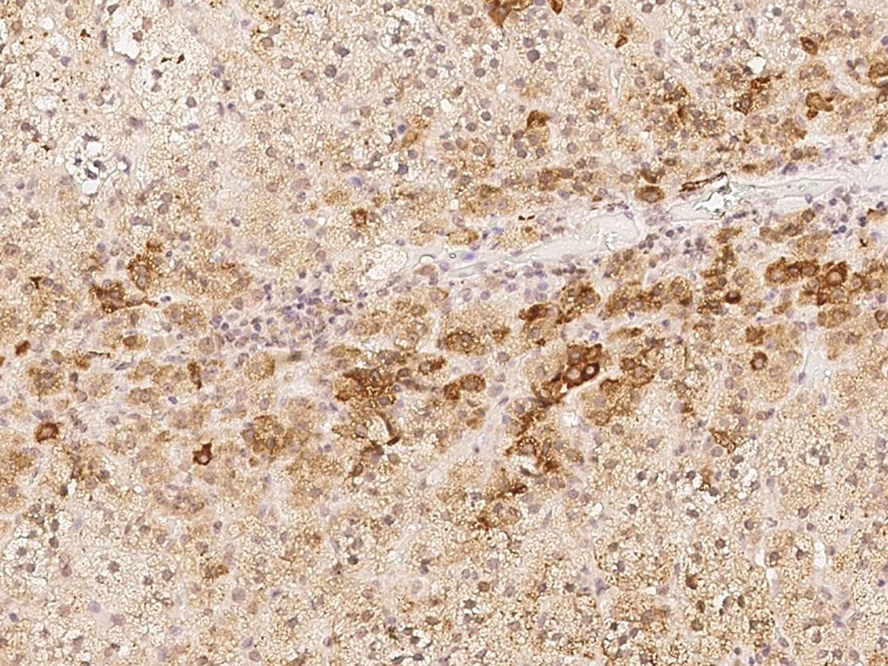Polyclonal Rabbit anti-Human PNMAL2 Antibody (IHC)