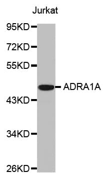Polyclonal Rabbit anti-Human ADRA1A Antibody (WB)