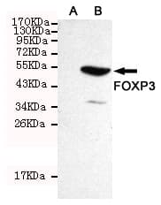 FOXP3 Antibody