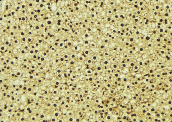 PSMA1 Antibody