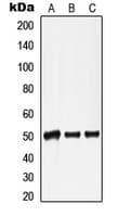 Polyclonal Rabbit anti-Human LMNA / Lamin A+C Antibody (Internal, IHC, WB)