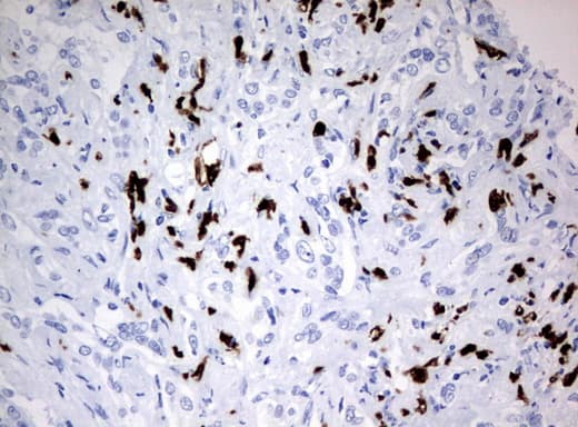 Monoclonal Mouse anti-Human PBX1 Antibody (clone UMAB111, Carrier-free, IHC, IF)