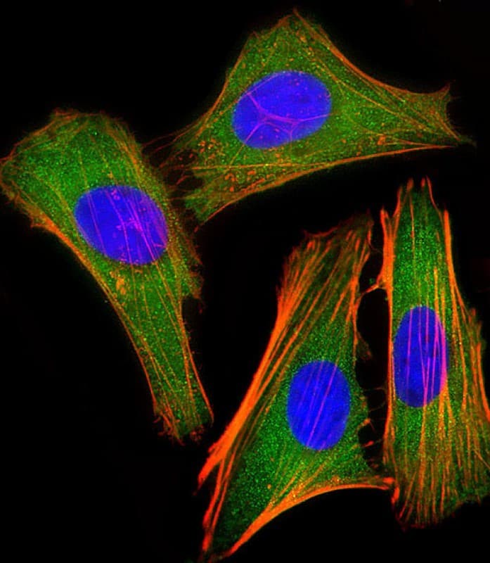IRF3 Antibody (clone 1522CT766.58.24)