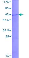 Human KLK5 / Kallikrein 5 Protein (Recombinant GST)