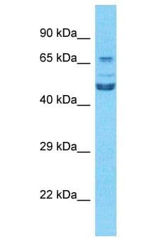Polyclonal Rabbit anti-Human TCF3 / E2A Antibody (aa51-100, WB)