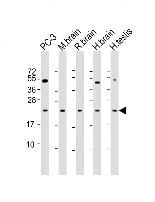 Monoclonal Mouse anti-Human RAB18 Antibody (clone 1573CT811.119.39, WB)
