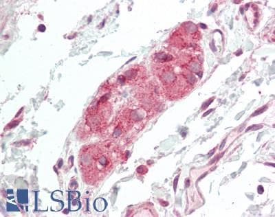 IHC-plus™ Polyclonal Rabbit anti-Human GRID1 Antibody (aa811-860, IHC, WB)