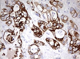 Monoclonal Mouse anti-Human KRT20 / CK20 / Cytokeratin 20 Antibody (clone OTI3G1, IHC, WB)