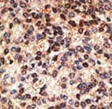 Polyclonal Rabbit anti-Human JAG2 / Jagged-2 Antibody (aa1209-1238, IHC, WB)