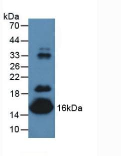 TTR / Transthyretin Antibody (aa21-147)