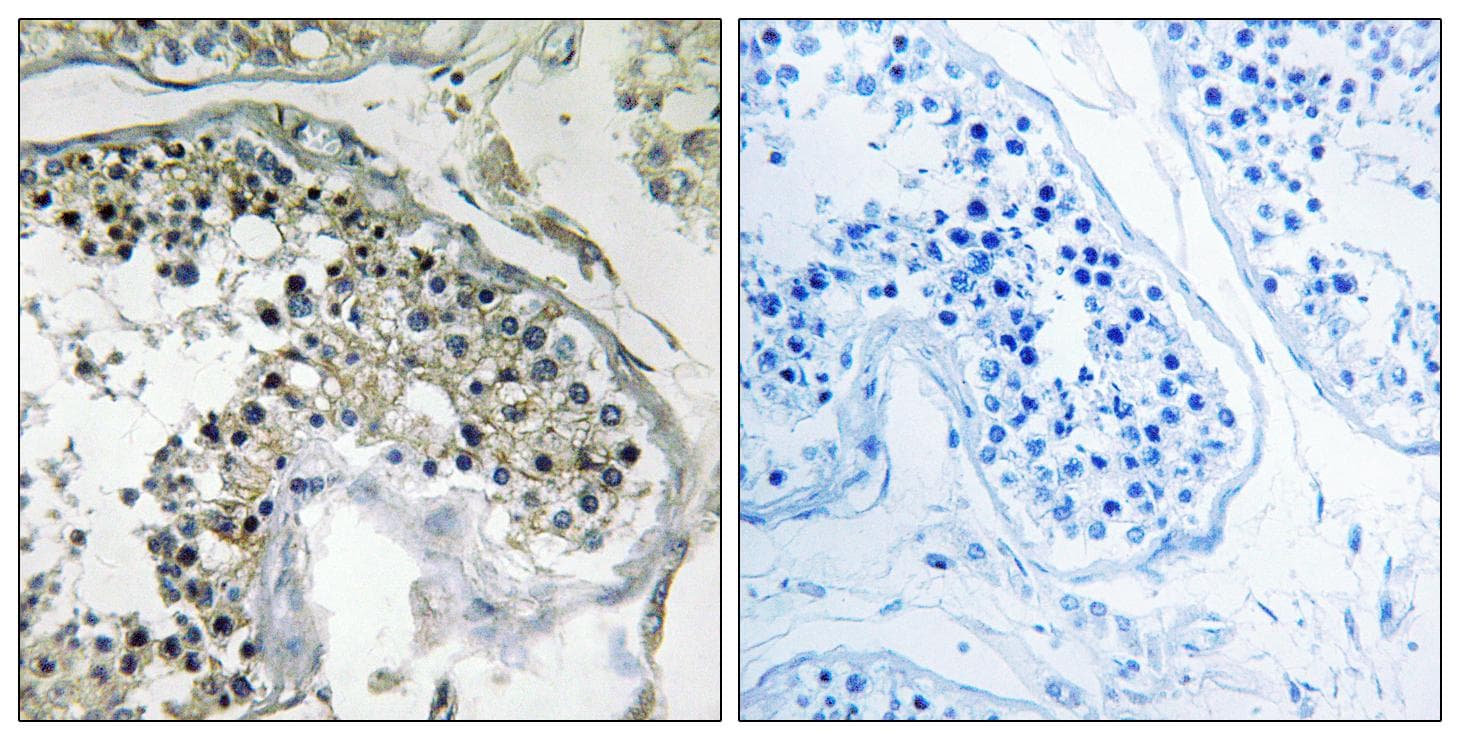Polyclonal Rabbit anti-Human PPP1R1C Antibody (IHC)