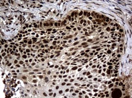 PCNA Antibody (clone OTI3F11)