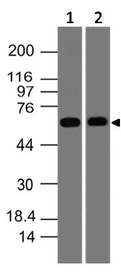 Polyclonal Rabbit anti-Human SWAP70 Antibody (WB)