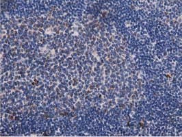 P5CR2 / PYCR2 Antibody (clone OTI5C7)