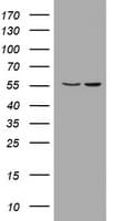 Monoclonal Mouse anti-Human PIK3CD / PI3K Delta Antibody (clone OTI1B5, aa286-610, IHC, WB)