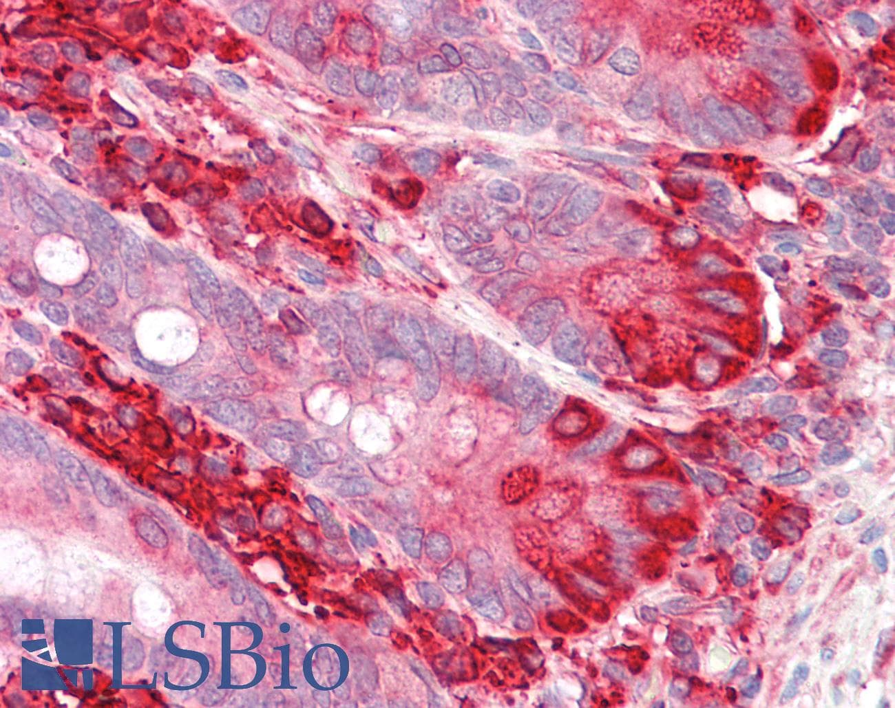 IHC-plus™ TXNDC5 / ERP46 Antibody (aa419-432)