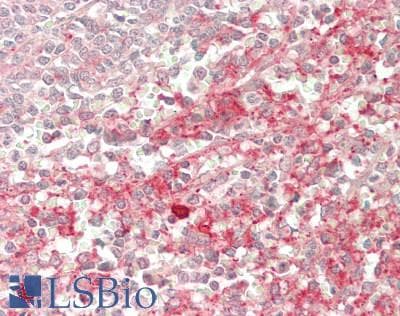 IHC-plus™ Polyclonal Sheep anti-Human CXCL4 / PF4 Antibody (IHC)