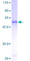 Human SC4MOL Protein (Recombinant GST)