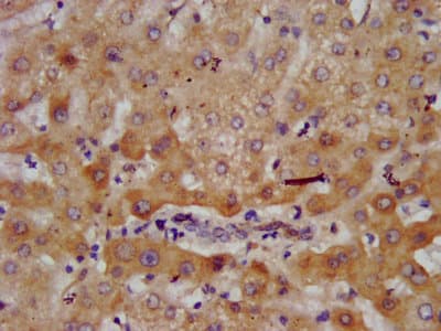 Polyclonal Rabbit anti-Human AGXT2 Antibody (IF, WB)