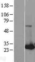 RAB32 Protein (Over-Expression Lysate Myc-DDK (Flag))