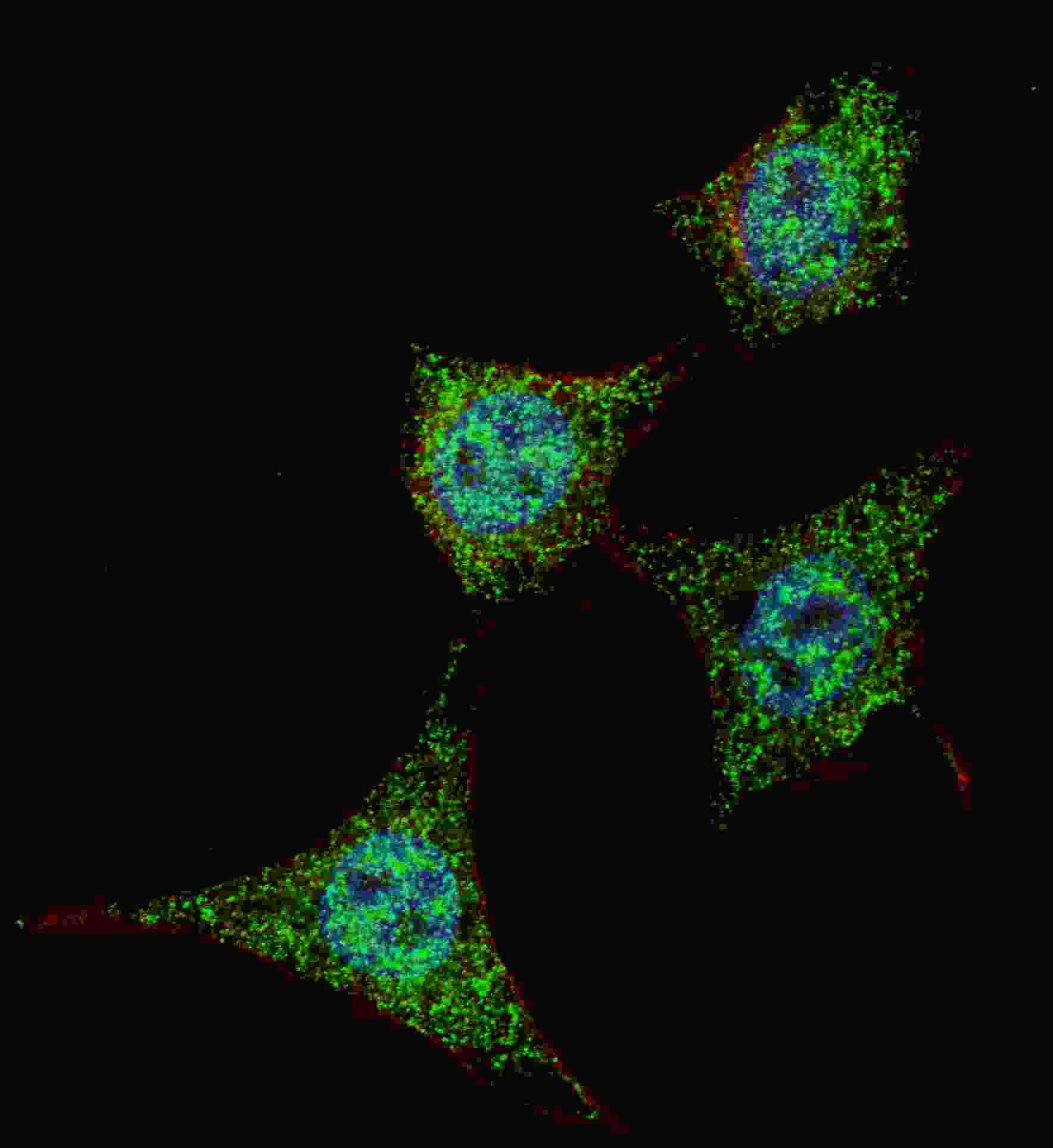 Polyclonal Rabbit anti-Human BAD Antibody (phospho-Ser99, IHC, IF, WB)
