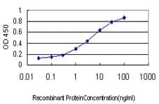 PathPlus™ Monoclonal Mouse anti-Human SF1 Antibody (clone 2E12, IHC, IF, WB)