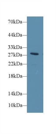DIO3 Antibody (aa11-277, PE)