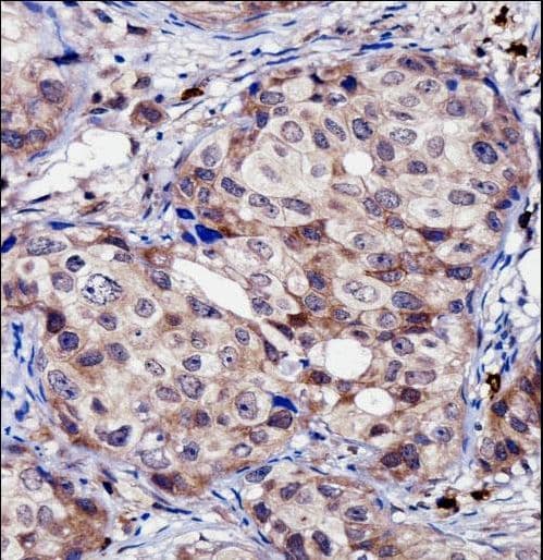 Polyclonal Rabbit anti-Human RNF144A / RNF144 Antibody (aa156-184, IHC, WB)